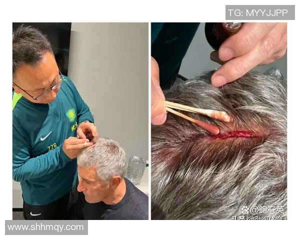 加纳足球队20号球星崭露头角 赛场表现引发全球关注